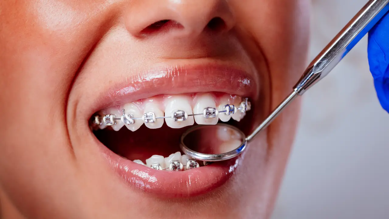Dentist examining a patient at Valley Dental Turlock