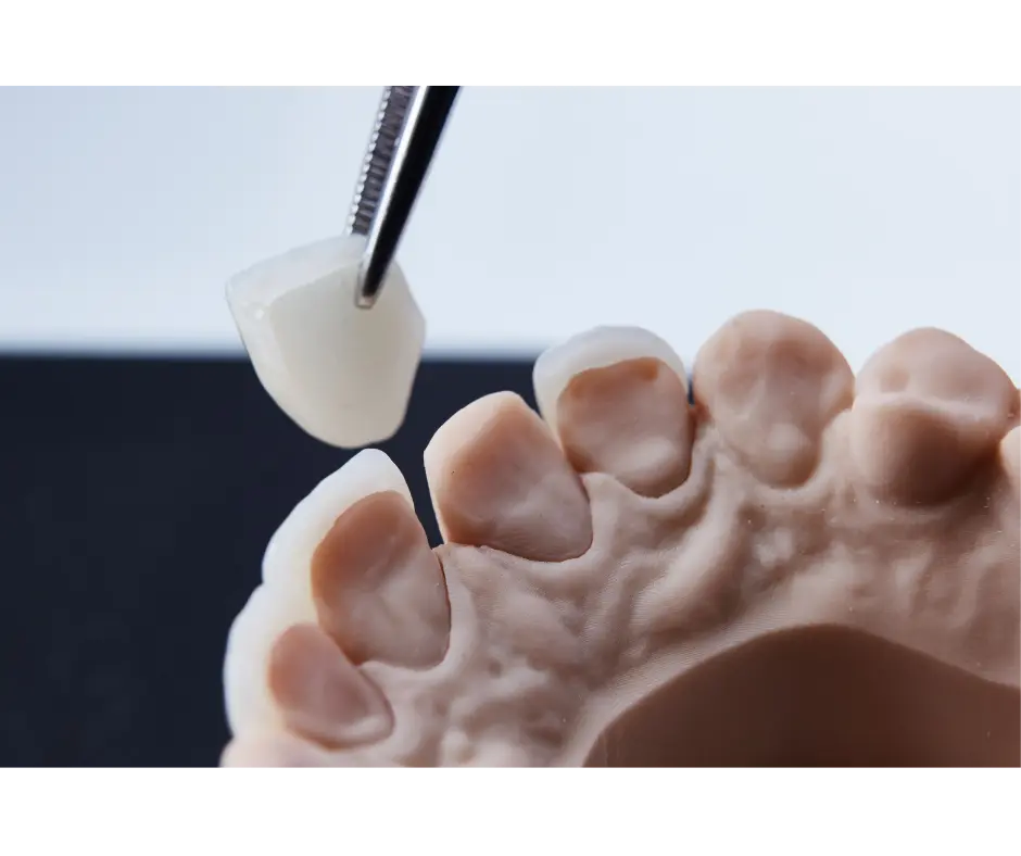 Cosmetic Dentistry at Valley Dental Turlock