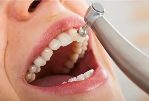 Preventive Dentistry