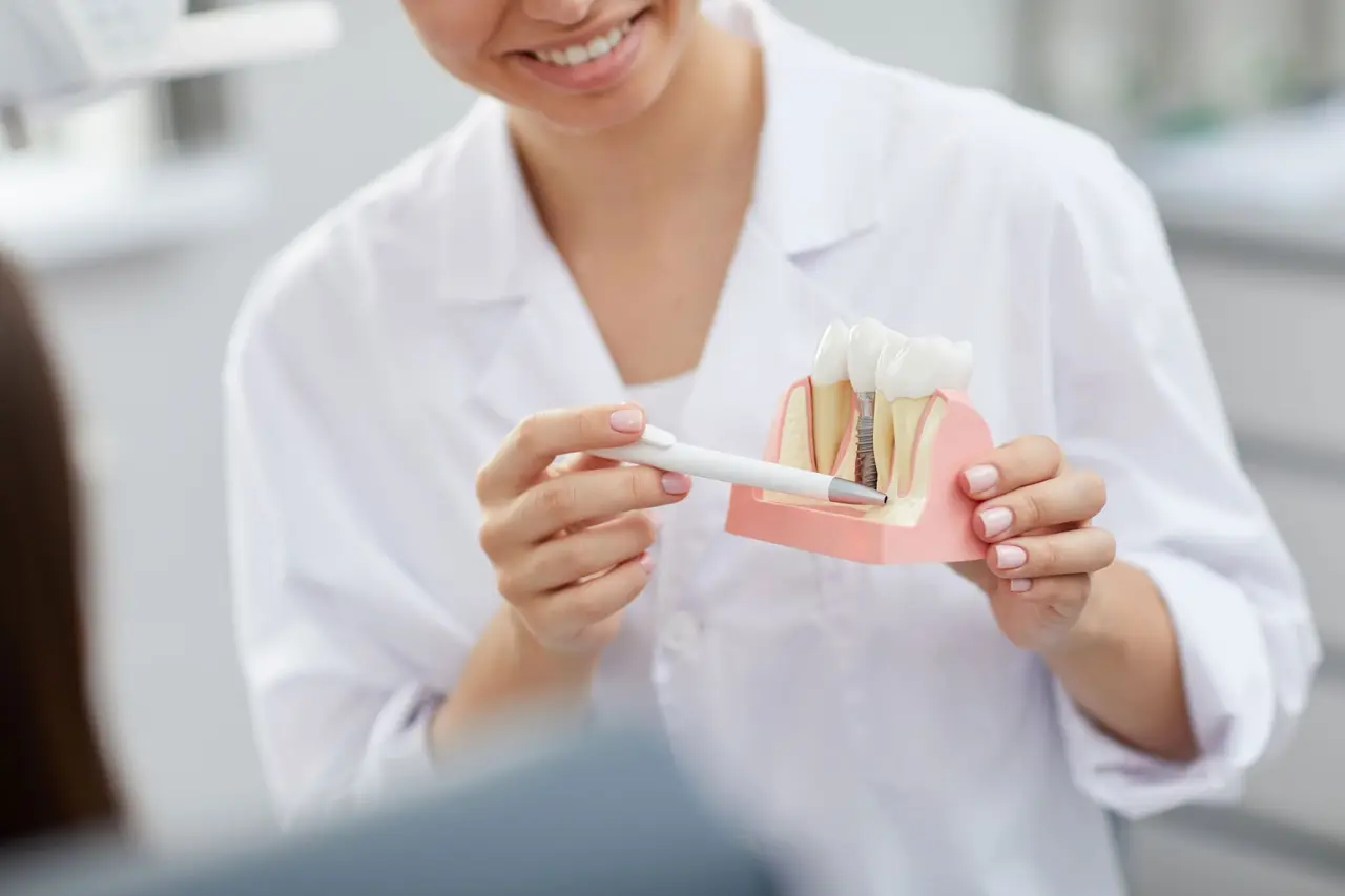 Dental Implants: What to Expect, Step by Step