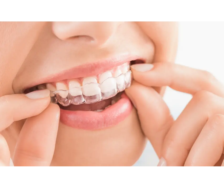 Person holding a clear aligner tray used to straighten teeth