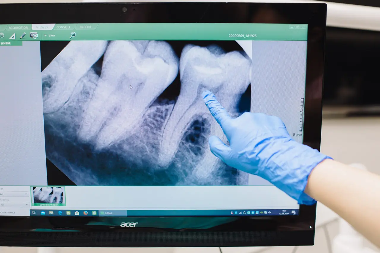 Patient receiving digital dental X-rays at Valley Dental Turlock